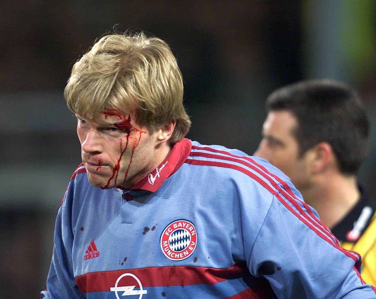 SC Freiburg - FC Bayern MÜnchen 1:2 Oliver Kahn mit einer Platzwunde am Kopf. Kahn wurde von einem Wurfgeschoss (Golfball) am Kopf getroffen. Im Hintergrund Schiedsrichter Uwe Kemmling